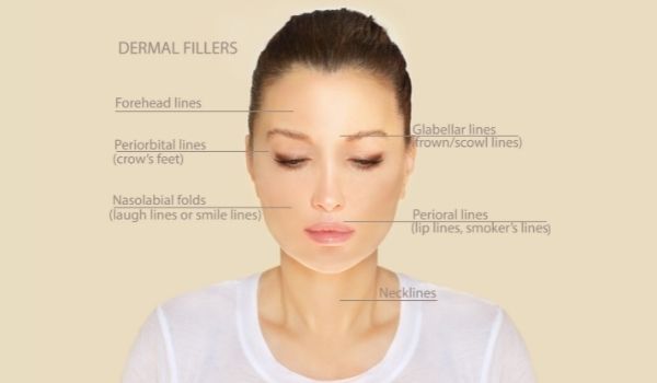Good candidates filler dissolving - Dr Michael Kernohan Leading Cosmetic Surgeon