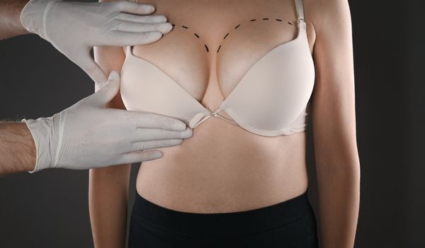 Small Breast Implants: When Mini Breast Augmentation Is Just Right
