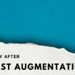 Recovery after breast augmentation surgery