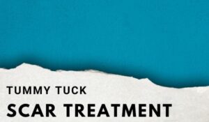 Tummy tuck scar treatment