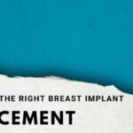 What is the right breast implant placement