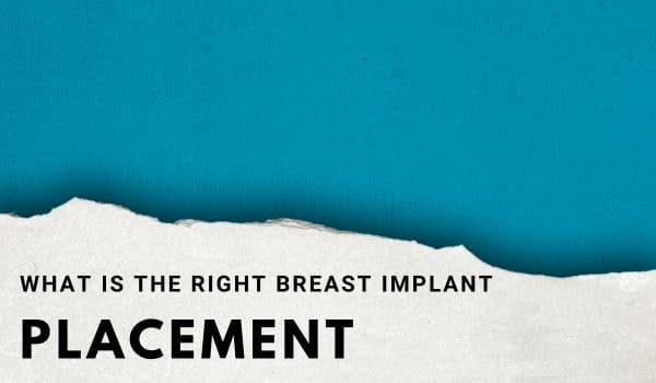 What is the right breast implant placement