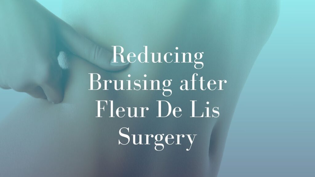Reducing Bruising after Fleur De Lis Surgery