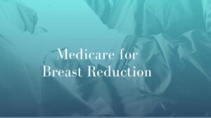 Medicare for Breast Reduction