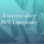 Exercise after Belt Lipectomy