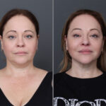 depp-plane-before-and-after