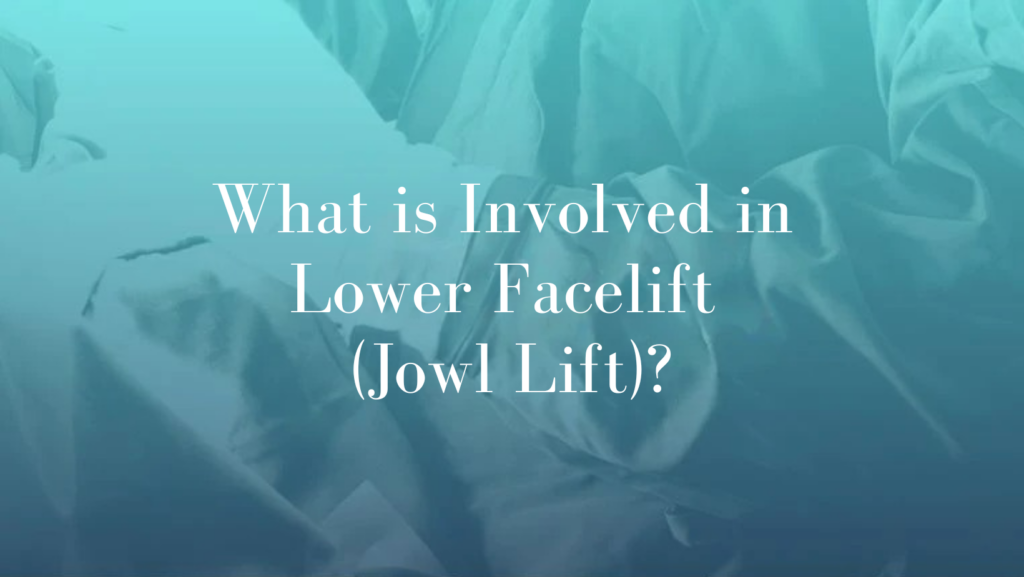 What is Involved in Lower Facelift (Jowl Lift)