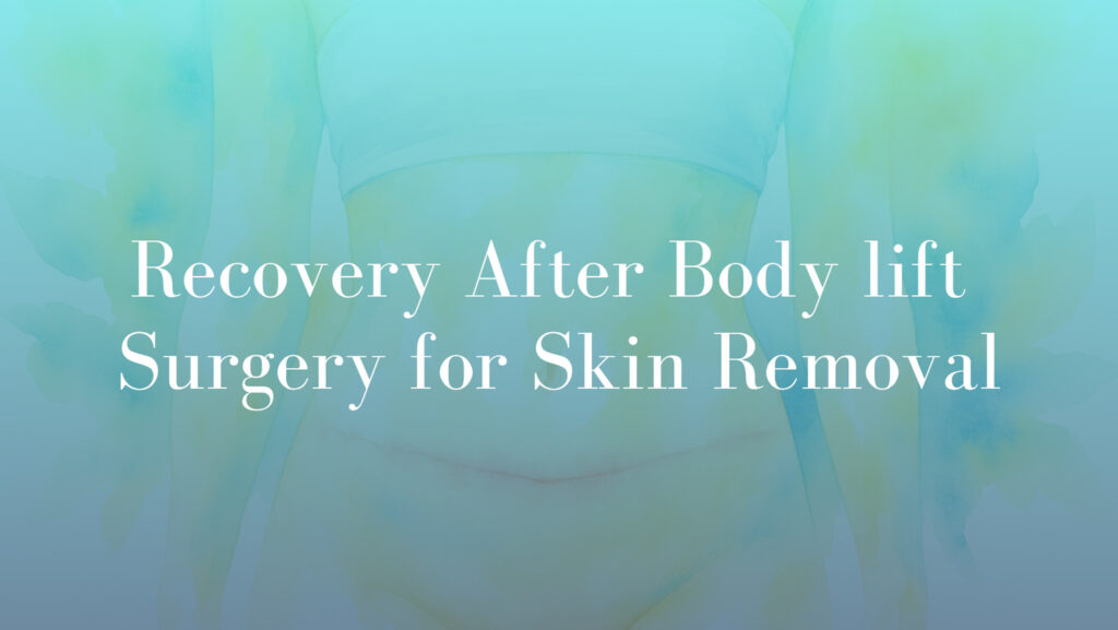 Recovery After Body lift Surgeryfor Skin Removal Micheal Kernohan