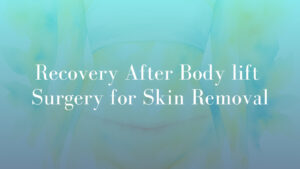 Recovery After Body lift Surgeryfor Skin Removal Micheal Kernohan