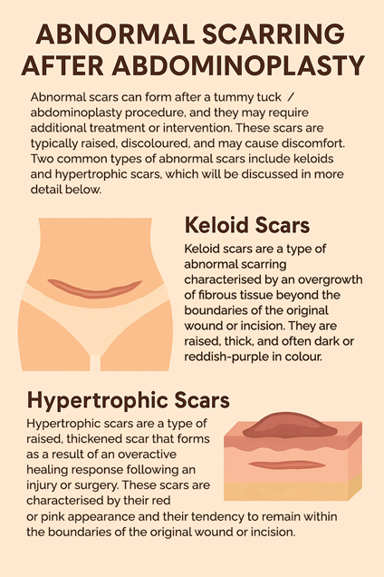 Abnormal Scarring after Abdominoplasty by Dr Michael Kernohan Abnormal Scarring after Abdominoplasty by Dr Michael Kernohan