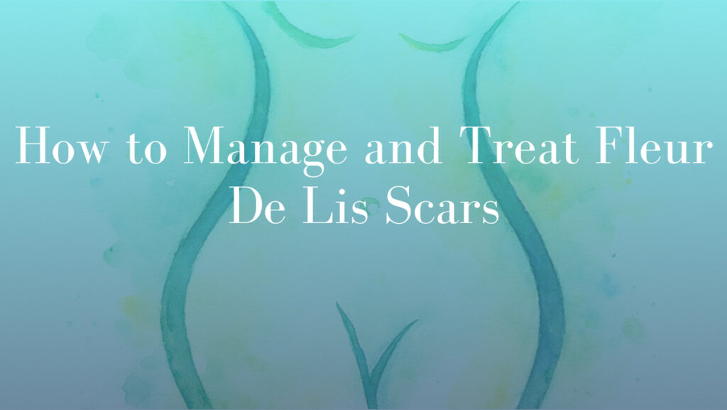 How to Manage and Treat Fleur De Lis Scars by Dr Michael Kernohan