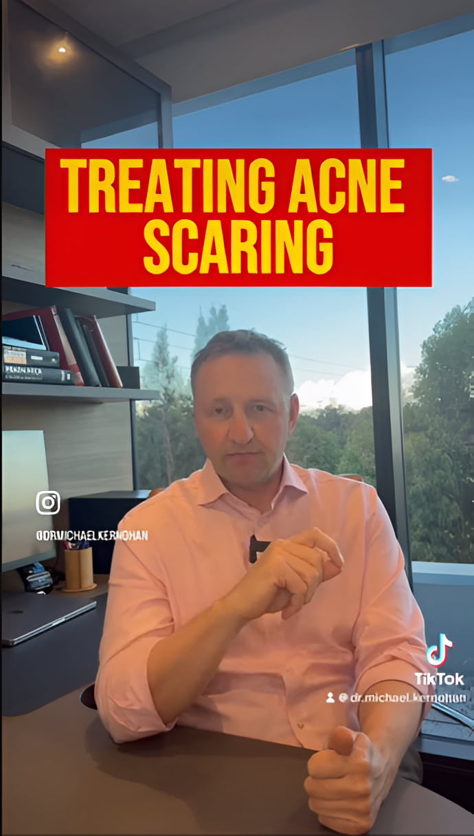 Watch Dr Kernohan Explains How to Treat Acne Scaring - YouTube- YouTube Videos