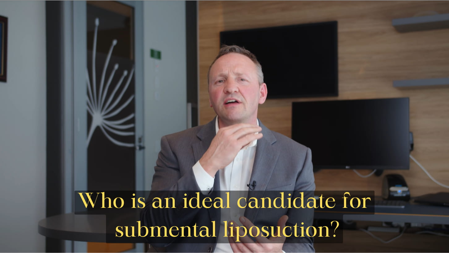 Candidate for submental liposuction Image for Youtube Video - Dr Kernohan image