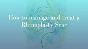 How to manage and treat a Rhinoplasty Scar by Dr Michael Kernohan