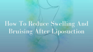 How To Reduce Swelling And Bruising After Liposuction by Dr Michael Kernohan