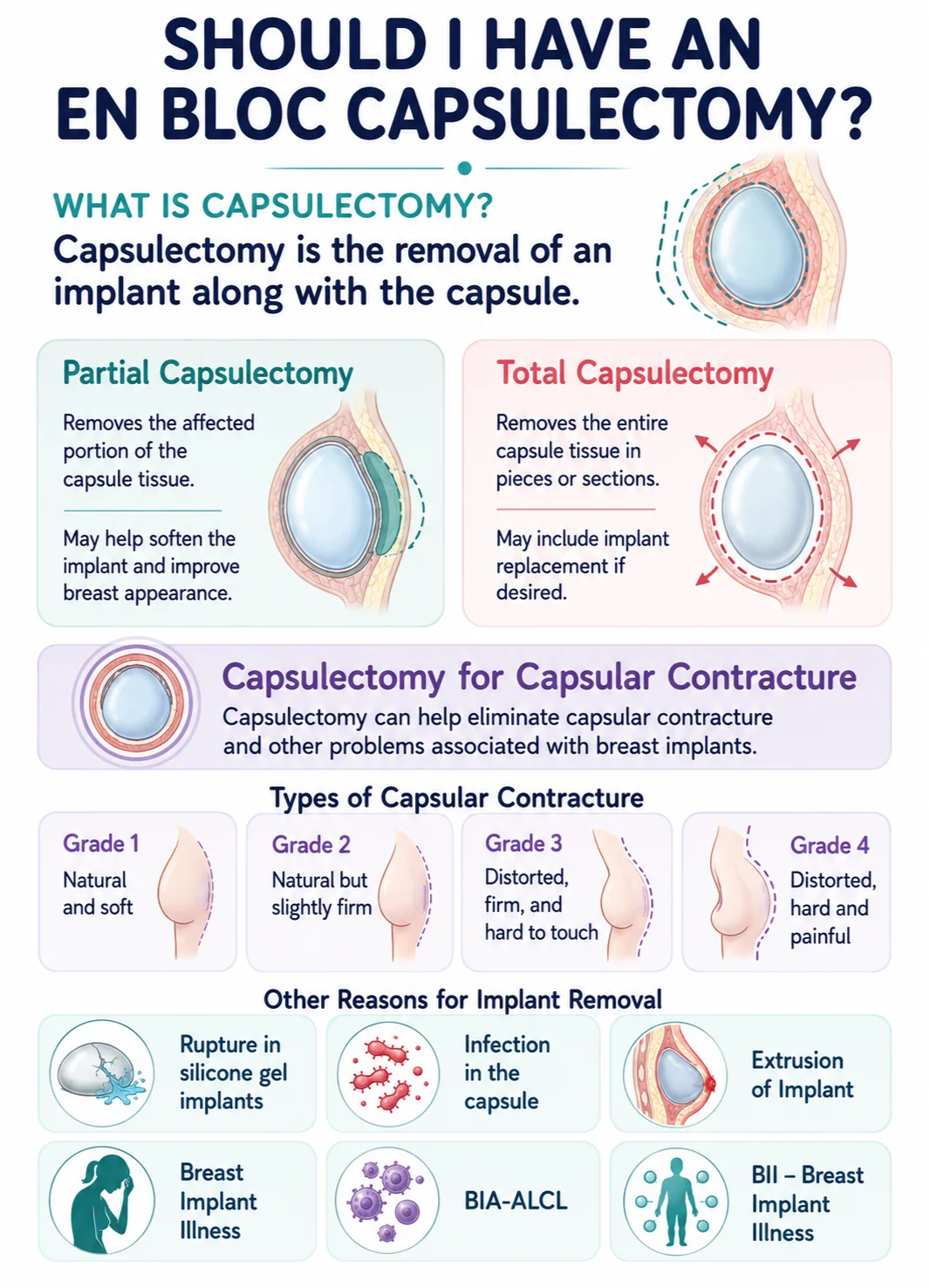 Should i have an en bloc capsulectomy infographic image by Dr Kernohan