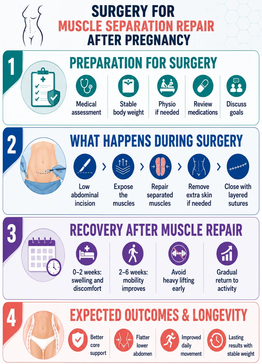 Surgery for muscle separation repair after pregnancy infographic image by Dr Kernohan