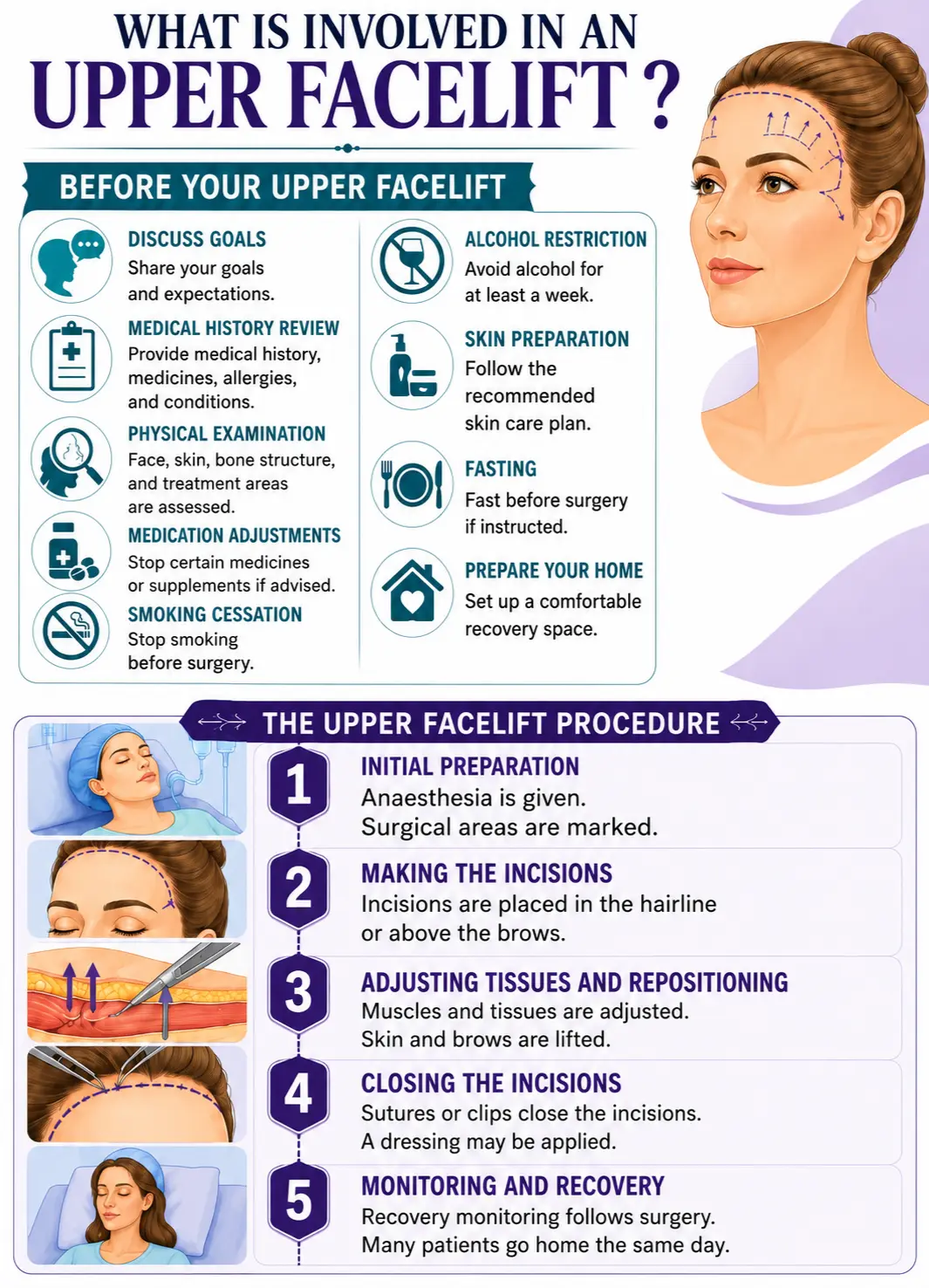 What is involved in an upper facelift infographic image by Dr Kernohan